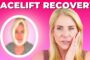 Before You Get a Facelift, Watch This: What I Wish I’d Known